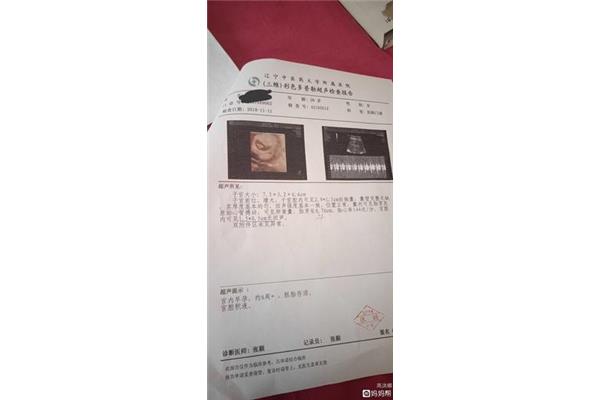 盆腔积液抽一次要多少钱?如何清除盆腔积液?