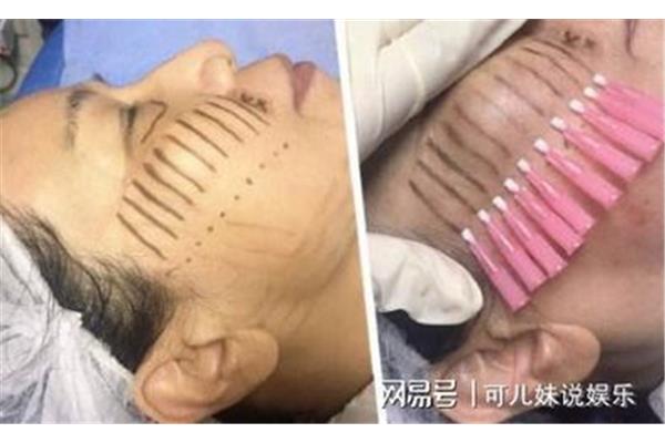 Eye埋线多久可以化妆,done埋线多久可以化妆