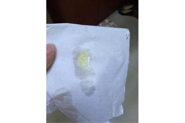 女性分泌物可以吃吗?女生的白色分泌物有哪些?